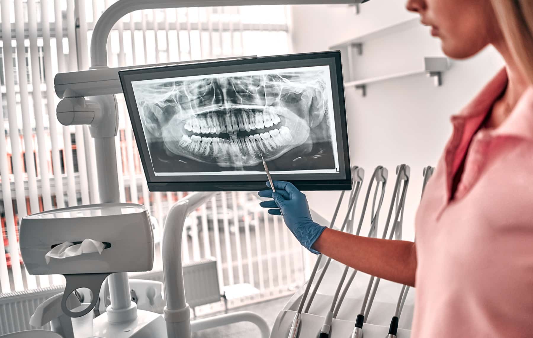 Reviewing a panoramic X-ray chairside